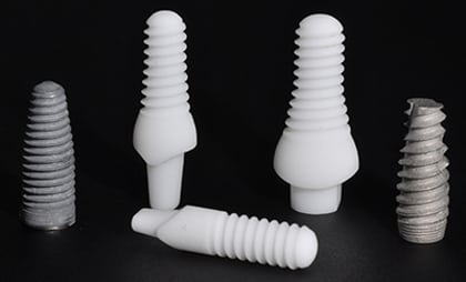 An image of traditional and metal free dental implants