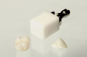 Image of CEREC crown restorations
